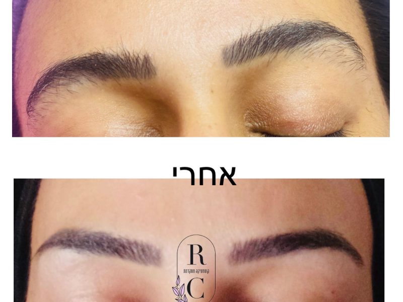 רחלי עוזרי | Racheli Cosmetics | קוסמטיקה רפואית | הסרת שיער | טיפולי פנים מתקדמים בתל אביב