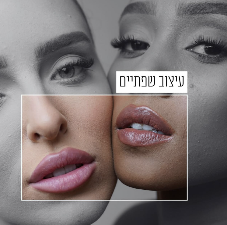 ד״ר נשאת אבו עאמר | dr.nashad.aesthetics | אסתטיקה רפואית | טיפולי פנים מתקדמים | מומחה להרמוניה פנים