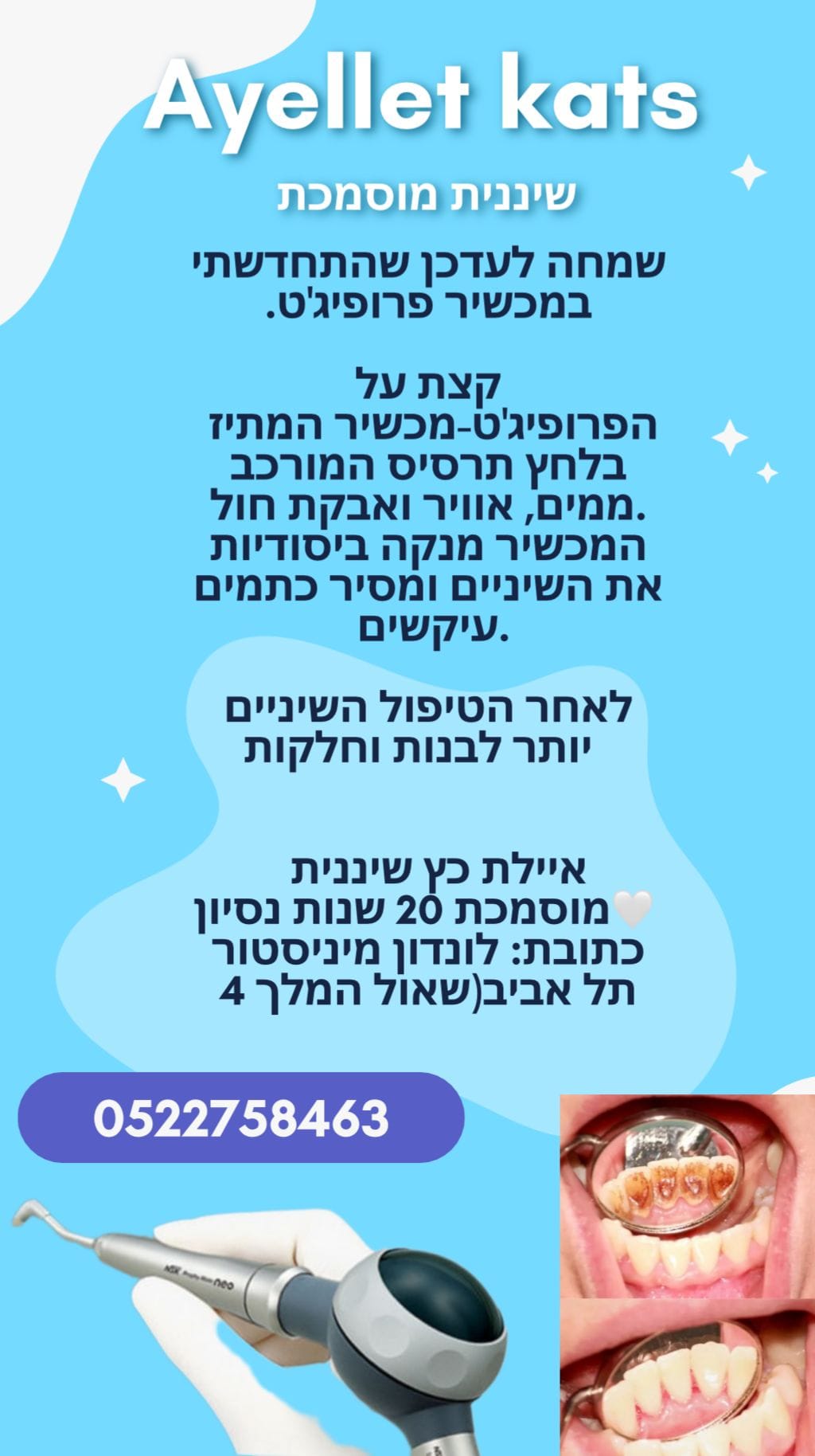 איילת כץ שיננית | טיפולי שיניים מקצועיים | היגיינת הפה | ניקוי שיניים | תל אביב